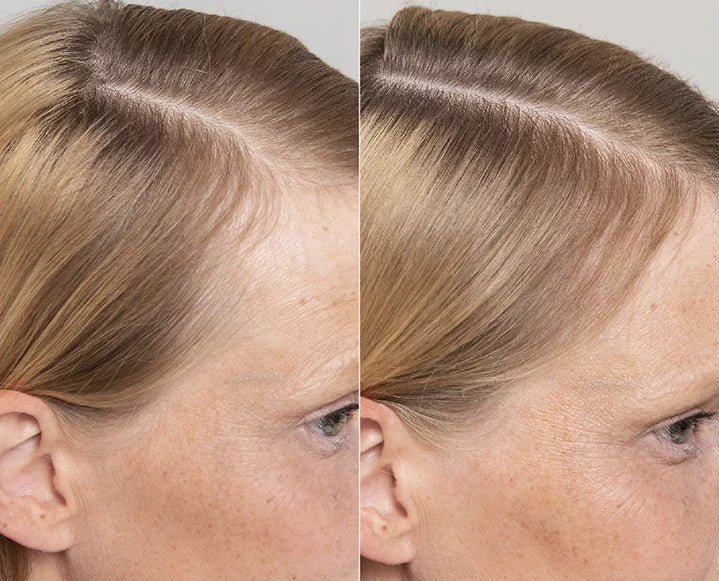 Follicle Repair & Thickening Essence