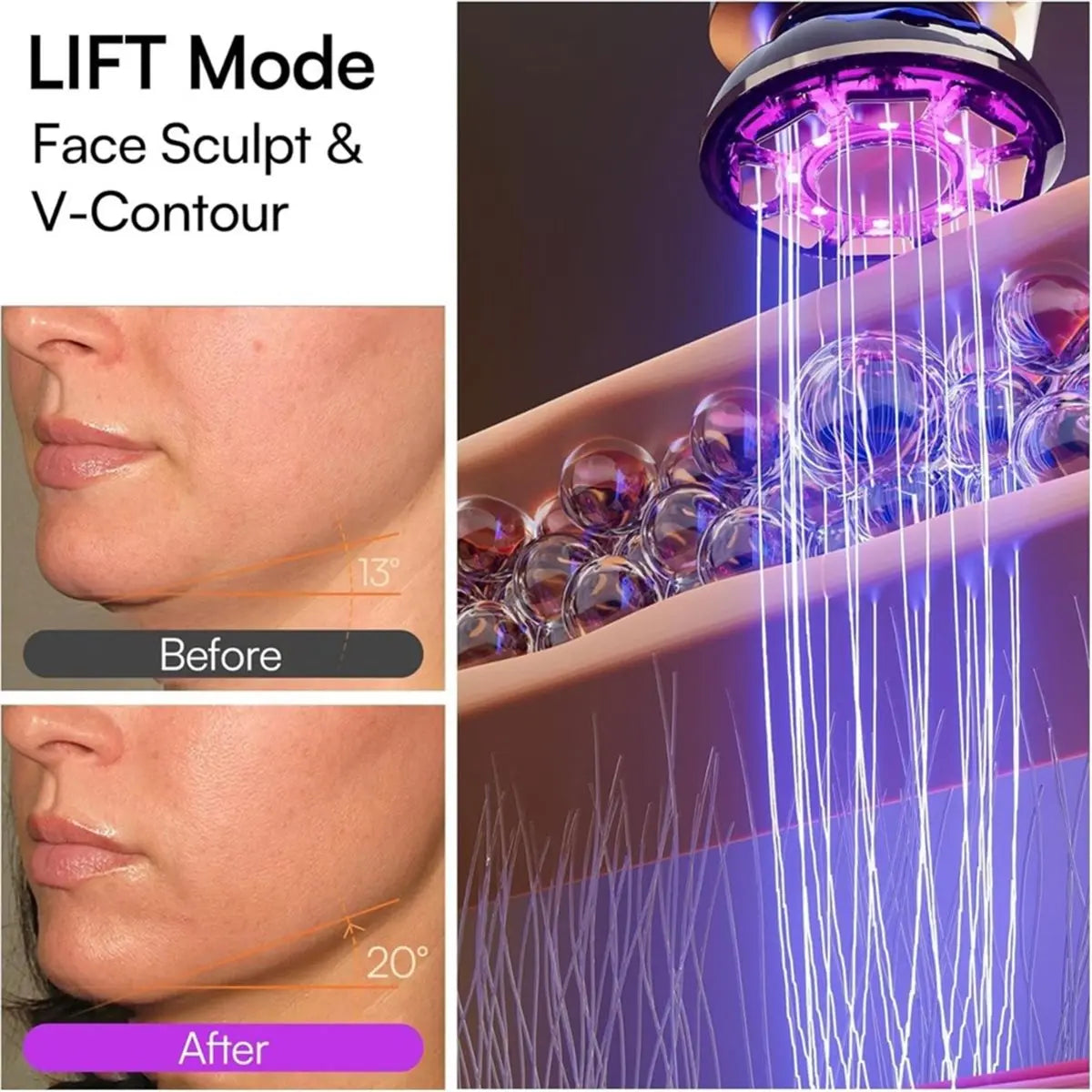 Sculpt and Lift Facial System