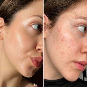 Trendhut Glass Glow Korean Skincare 5 pcs Set™