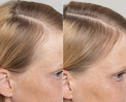 Follicle Repair & Thickening Essence